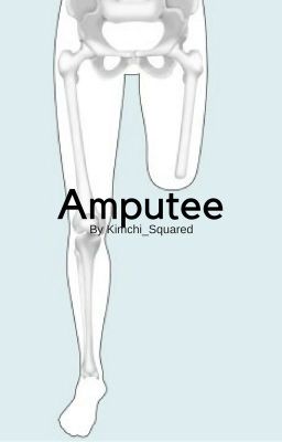 Amputee