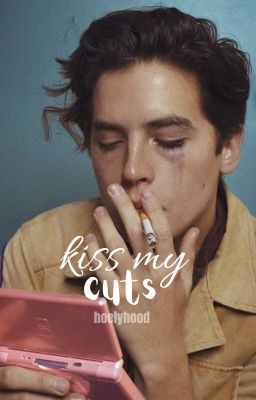 kiss my cuts ❥ poetry