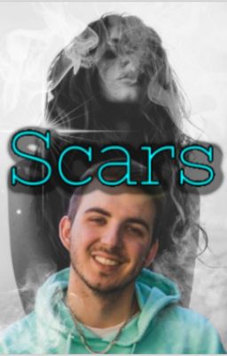 Scars