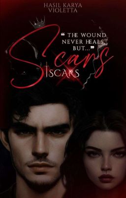 SCARS | SLOW UPDATE 