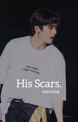 His Scars || Minsung